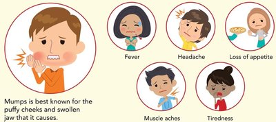 Mumps symptoms cartoon