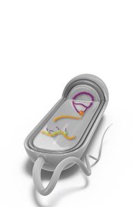 Splicing of eukaryotic mRNA: introns removed, exons joined