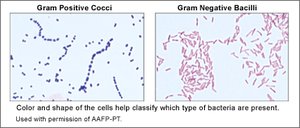 Gram Positive Cocci and Gram Negative Bacilli
