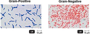 Gram-positive and Gram-negative bacteria after staining