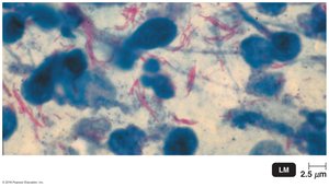 Mycobacterium tuberculosis, acid-fast cell wall