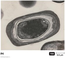 Endospore of Bacillus subtilis