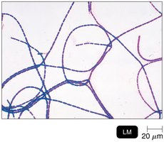 Gram-stained Bacillus anthracis