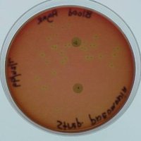 Alpha hemolysis on blood agar
