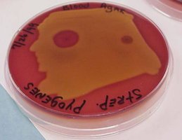 Beta hemolysis on blood agar