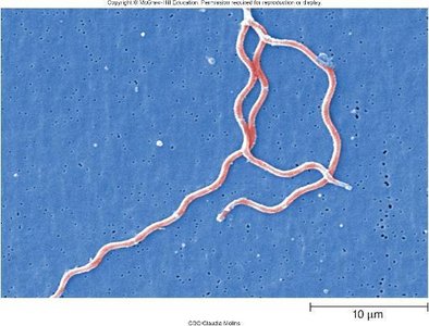 Borrelia burgdorferi spirochete under microscope