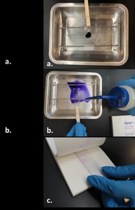 Photographs of simple staining procedure: staining, rinsing, drying