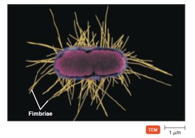 Fimbriae on a bacterial cell (TEM)