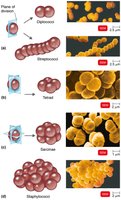 Arrangements of bacterial cells: diplococci, streptococci, tetrad, sarcinae, staphylococci
