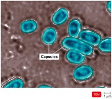 Bacterial capsules (TEM)