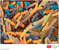 Normal intestinal bacteria