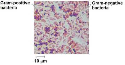 Gram stain procedure steps