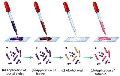 Gram-positive vs Gram-negative cell wall structure