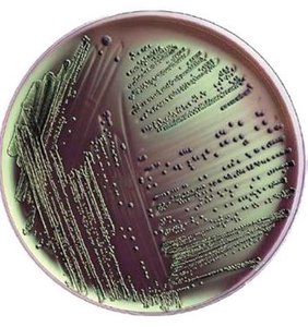 E. coli on EMB agar