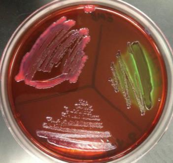 Differential growth on EMB agar