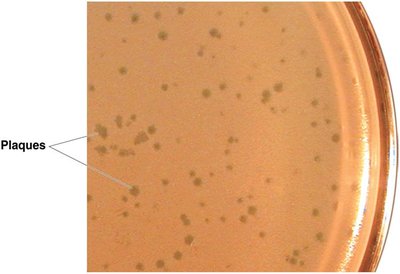 Plaques formed by bacteriophages on a bacterial lawn