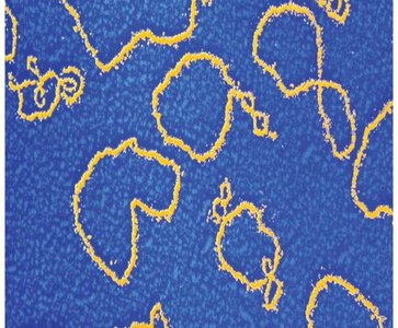 Plasmids in bacterial cells