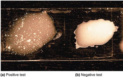 Slide agglutination test
