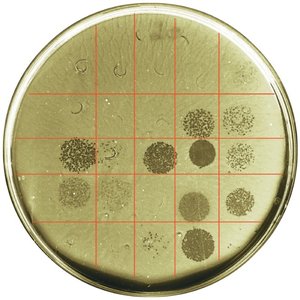Phage typing of Salmonella enterica