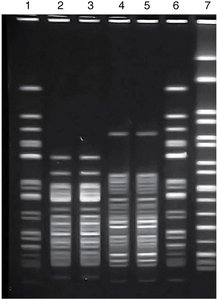 DNA fingerprinting gel