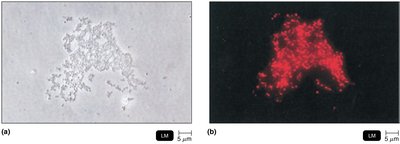 FISH: Fluorescent in situ hybridization