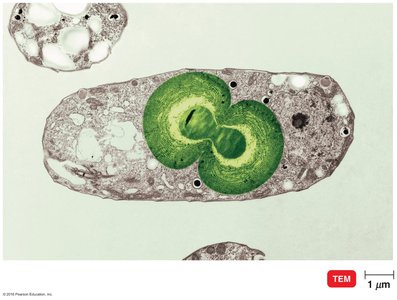 TEM of Cyanophora paradoxa, showing endosymbiosis