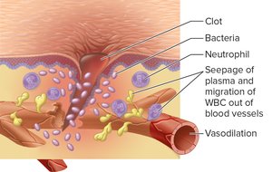 Vasodilation and neutrophil migration in inflammation