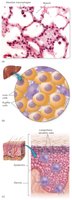 Histiocytes in liver and skin