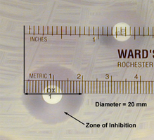 Measuring the zone of inhibition with a ruler