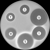 Kirby-Bauer disk diffusion plate with multiple antibiotics