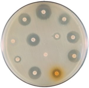 Kirby-Bauer disk diffusion test