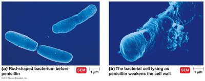 SEM images of bacteria before and after penicillin treatment