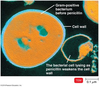 TEM image of gram-positive bacterium lysing after penicillin