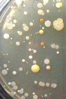 Bacterial colonies on nutrient agar before handwashing