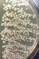 Bacterial colonies on nutrient agar after 2 minutes of handwashing