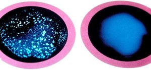 Latex agglutination test for Staphylococcus aureus: positive and negative results