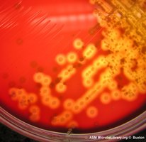 Blood agar plate showing beta-hemolytic colonies of Streptococcus pyogenes