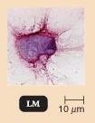 Dendritic cell under light microscope