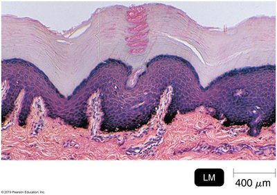Histological section of skin showing epidermis and dermis