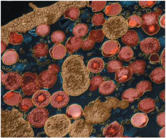 SARS-CoV-2 virus particles