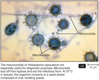 Histoplasma capsulatum macroconidia and microconidia