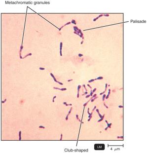 Corynebacterium diphtheriae under the microscope