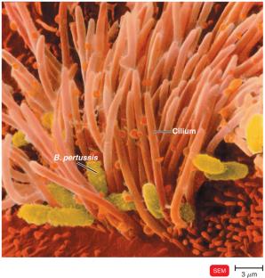 Ciliated cells of the respiratory system infected with Bordetella pertussis
