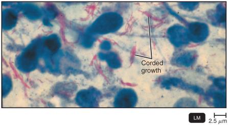 Mycobacterium tuberculosis under the microscope