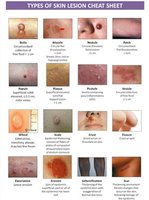 Types of skin lesions cheat sheet