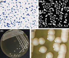 Staphylococcus colonies and cells under microscope