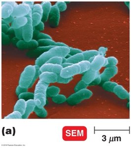 SEM of bacteria