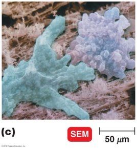 SEM of protozoa with pseudopods