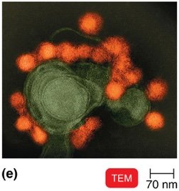 TEM of virus particles