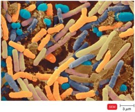 Normal intestinal bacteria SEM